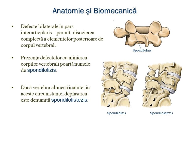 Afectiunile coloanei vertebrale